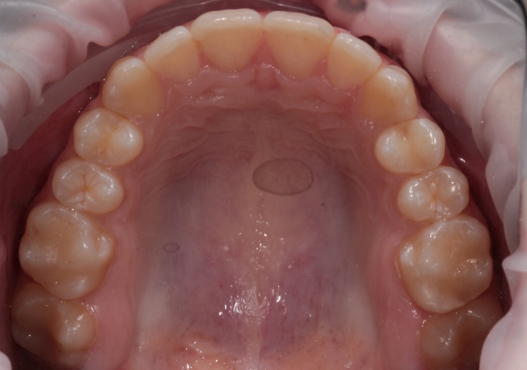 После лечения